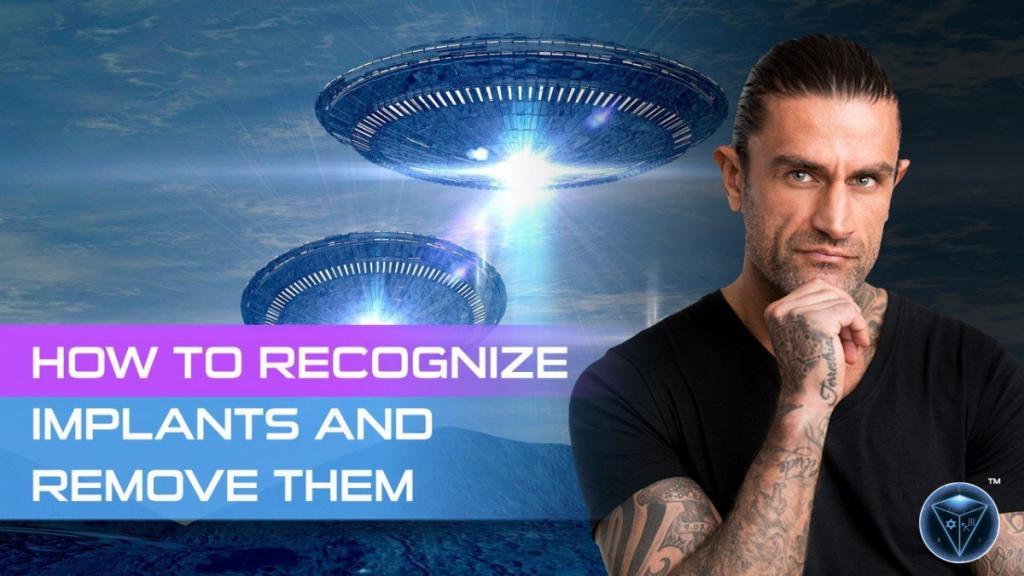 Video: How to Recognise Implants and Remove Them