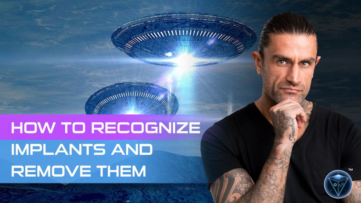 How to Recognise Implants and Remove them