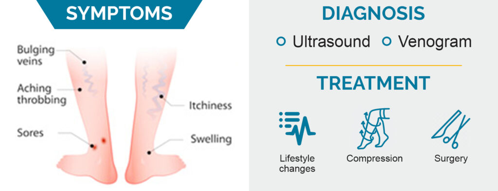 Symtoms & Diagnosis of Varicose Veins  - Star Magic Healing