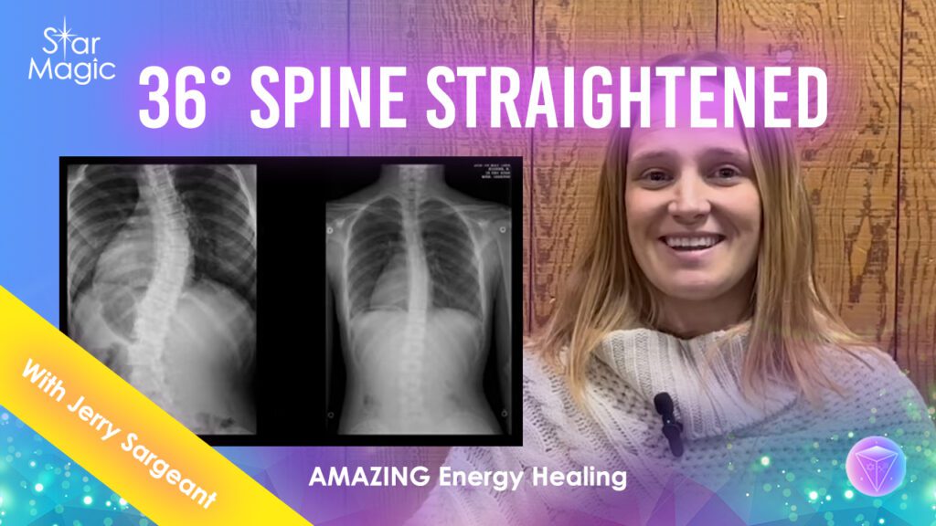 My Spine Is Now Straight Testimonial Video | Jerry Sargeant